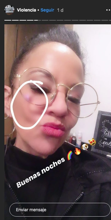 Y entonces, María Paz comenzó a mostrar imágenes con huellas de violencia...