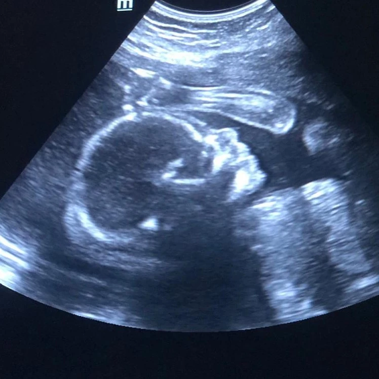 La ecografía de Capri que compartieron en abril Rifle Varela y Pía Marcollese.