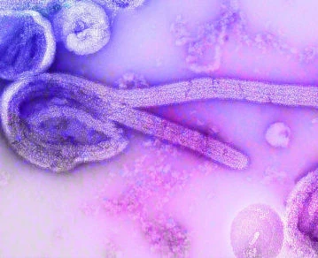 Imagen de microscopio electrónico de un ebolavirus