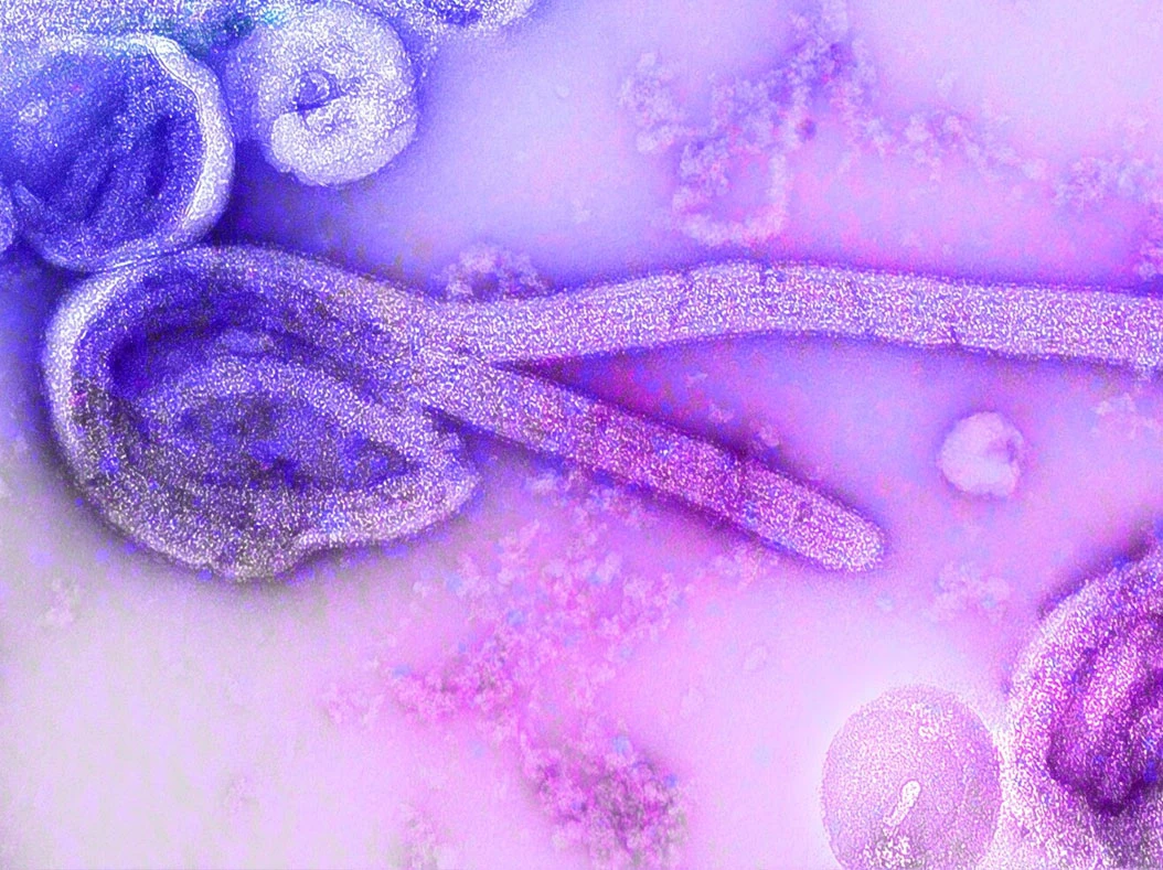 Imagen de microscopio electrónico de un ebolavirus