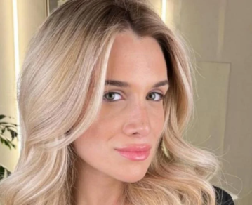 Camila Homs mostró su último retoque estético