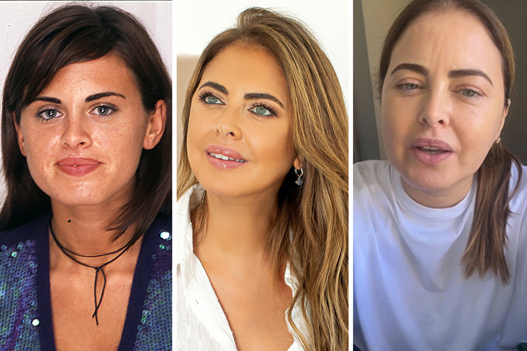 Silvina Luna murió a los 43 años la cirugía que "cambió todo para