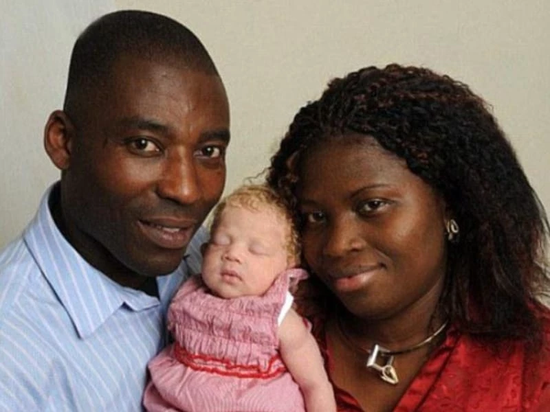 Increíble pero real: la historia de la familia nigeriana que concibió una hija rubia. Foto archivo