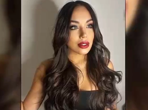 El sorprendente testimonio de Triana, la mujer que se operó 17 veces con Aníbal Lotocki