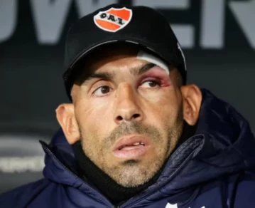 Carlos Tévez sufrió un duro accidente doméstico