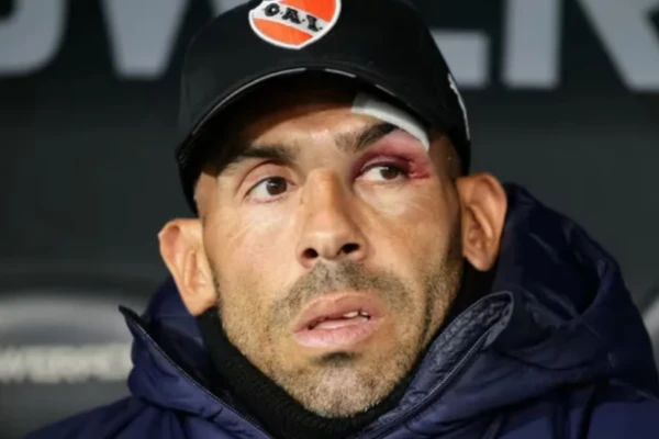 Carlos Tévez sufrió un duro accidente doméstico