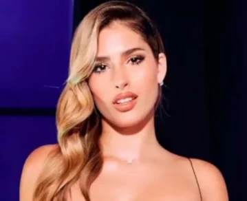 Julieta Poggio mostró cómo quedó su cara tras sufrir un accidente