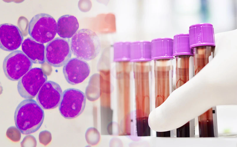 En el caso de Furia, se hará análisis de sangre mesuales para corroorar que los valores estén dentro de lo indicado. 