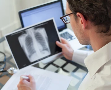 neumonias atipicas neumodengue