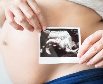 Qué es la ovodonación: el método que cambia la vida de las mujeres que no pueden tener hijos