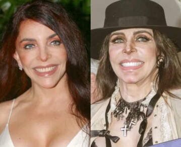 El antes y después de Verónica Castro y otras cinco famosas irreconocibles