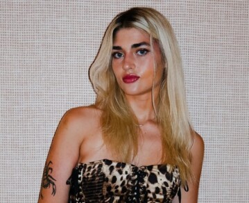 La aclaración de Marta Fort sobre la condición neurológica que padece desde que nació