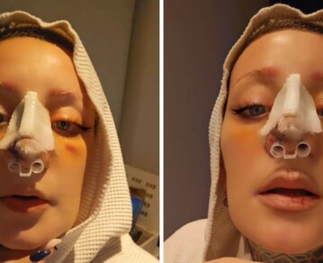 La complicación de Furia tras someterse a una operación: "Todo lleva su proceso"