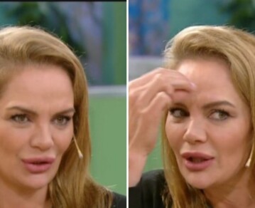 El impactante relato de Eliana Guercio tras someterse a un fallido tratamiento estético: "Me quemaron la cara"