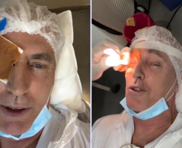 “Parezco un pirata”: Marley fue operado de nuevo y mostró cómo avanza su recuperación