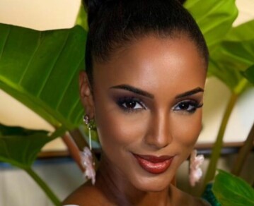 El nuevo y preocupante parte médico de la representante de Jamaica en Miss Universo a días de la brutal caída