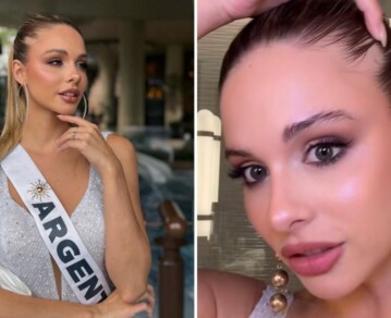 La emotiva revelación de Aldana Masset, la representante de Argentina en Miss Universo, que conmovió a los fans del certamen: "Tengo alopecia"