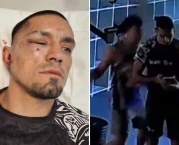 “Vivo con miedo”: el dramático relato del instructor de kickboxing atacado a traición en un gimnasio