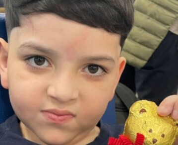 “Dios quiera que sea lo último”: preocupación por Bastián Jeréz ante una nueva cirugía clave