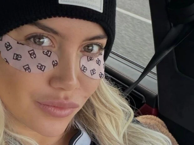 Qué hacen los parches con cafeína de Dolce & Gabbana que usa Wanda Nara