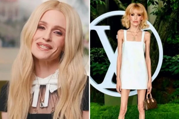la alarmante pérdida de peso de Kelly Osbourne