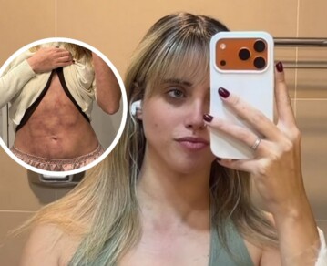 El crudo relato de Denisse González sobre los efectos de su nuevo tratamiento: "Hay partes del cuerpo que no sabía que podían doler”